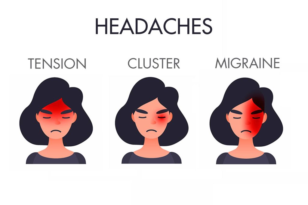 types of headache-chaatweb